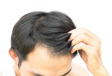 دلایل کاهش سرعت رشد مو چیست؟